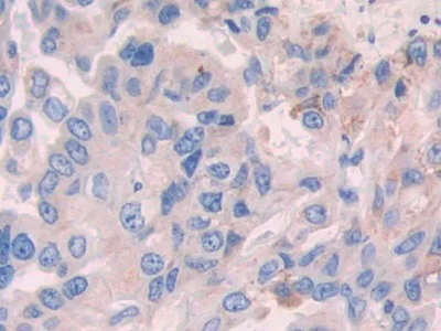 Immunohistochemistry (Formalin/PFA-fixed paraffin-embedded sections) - Anti-Alcohol Dehydrogenase antibody (AB231521)