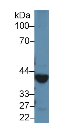 Western blot - Anti-Alcohol Dehydrogenase antibody (AB231521)