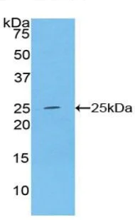 Western blot - Anti-Alcohol Dehydrogenase antibody (AB231521)