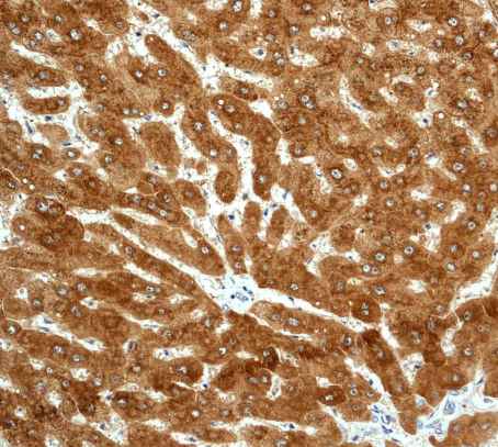 Immunohistochemistry (Formalin/PFA-fixed paraffin-embedded sections) - Anti-Alcohol Dehydrogenase antibody [EPR4439] (AB108203)