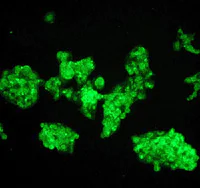 Immunocytochemistry/ Immunofluorescence - Anti-Alcohol Dehydrogenase antibody [EPR4439] - BSA and Azide free (AB247607)