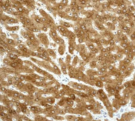 Immunohistochemistry (Formalin/PFA-fixed paraffin-embedded sections) - Anti-Alcohol Dehydrogenase antibody [EPR4439] - BSA and Azide free (AB247607)
