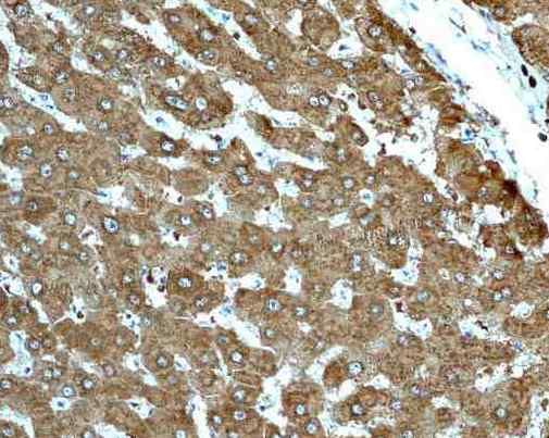 Immunohistochemistry (Formalin/PFA-fixed paraffin-embedded sections) - Anti-Alcohol Dehydrogenase antibody [EPR4440] (AB108197)