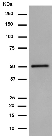Western blot - Anti-Aldehyde dehydrogenase 10 antibody [EPR15425(B)] (AB184171), expandable thumbnail