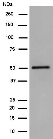Western blot - Anti-Aldehyde dehydrogenase 10 antibody [EPR15425(B)] (AB184171)