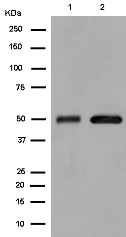 Western blot - Anti-Aldehyde dehydrogenase 10 antibody [EPR15425(B)] (AB184171)