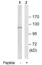 Western blot - Anti-Aldehyde Oxidase antibody (AB92519)