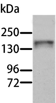 Western blot - Anti-Aldehyde Oxidase antibody - C-terminal (AB197828)