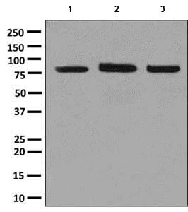 Western blot - Anti-ALDH16A1 antibody [EPR9216] (AB137073)