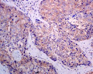 Immunohistochemistry (Formalin/PFA-fixed paraffin-embedded sections) - Anti-ALDH16A1 antibody [EPR9217] (AB137082)