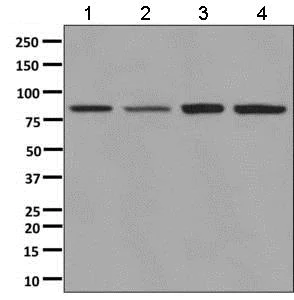 Western blot - Anti-ALDH16A1 antibody [EPR9217] (AB137082)