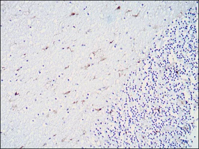 Immunohistochemistry (Formalin/PFA-fixed paraffin-embedded sections) - Anti-ALDH1A1 antibody [5A11] (AB105920)