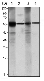 Western blot - Anti-ALDH1A1 antibody [5A11] (AB105920)