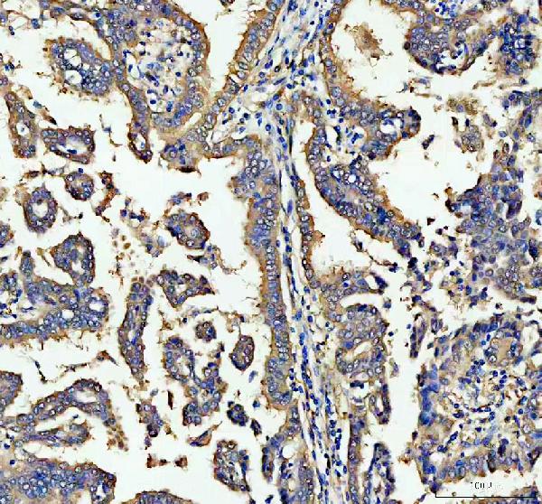 Immunohistochemistry (Formalin/PFA-fixed paraffin-embedded sections) - Anti-ALDH1A1 antibody (AB131068), expandable thumbnail