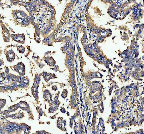 Immunohistochemistry (Formalin/PFA-fixed paraffin-embedded sections) - Anti-ALDH1A1 antibody (AB131068)