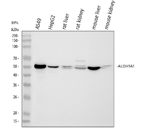 Western blot - Anti-ALDH1A1 antibody (AB131068), expandable thumbnail