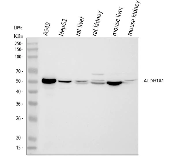 Western blot - Anti-ALDH1A1 antibody (AB131068)