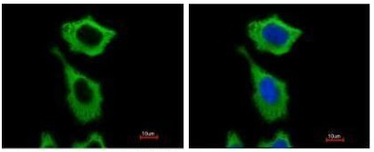 Immunocytochemistry/ Immunofluorescence - Anti-ALDH1A1 antibody (AB227948), expandable thumbnail