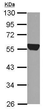 Western blot - Anti-ALDH1A1 antibody (AB227948), expandable thumbnail