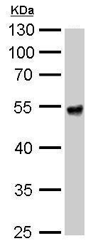 Western blot - Anti-ALDH1A1 antibody (AB227948), expandable thumbnail