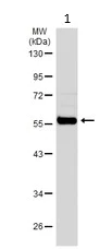Western blot - Anti-ALDH1A1 antibody (AB227948)