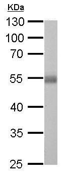 Western blot - Anti-ALDH1A1 antibody (AB227948), expandable thumbnail