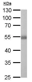 Western blot - Anti-ALDH1A1 antibody (AB227948)