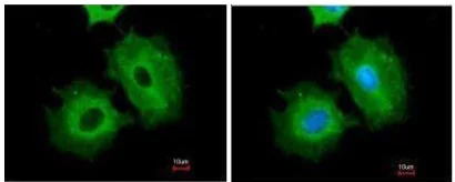 Anti-ALDH1A1 antibody (ab227964) | Abcam