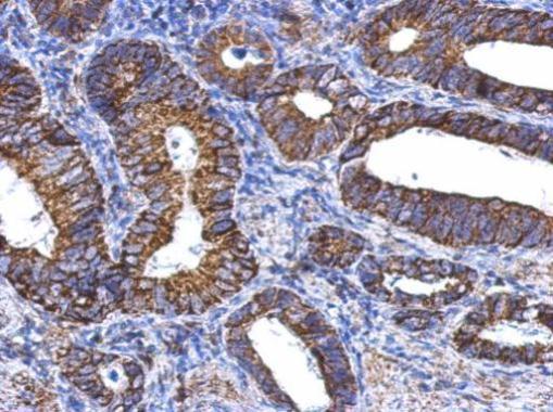 Immunohistochemistry (Formalin/PFA-fixed paraffin-embedded sections) - Anti-ALDH1A1 antibody (AB227964)