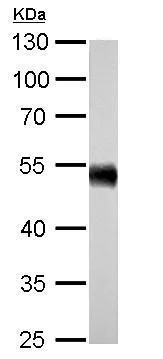 Western blot - Anti-ALDH1A1 antibody (AB227964)