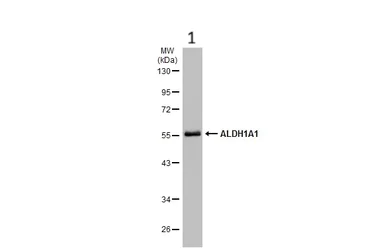 Western blot - Anti-ALDH1A1 antibody (AB227964)