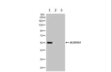 Western blot - Anti-ALDH1A1 antibody (AB227964)