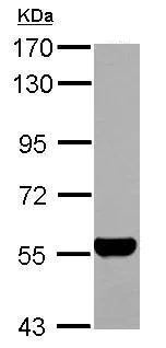 Western blot - Anti-ALDH1A1 antibody (AB227964)