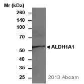 Western blot - Anti-ALDH1A1 antibody (AB9883)