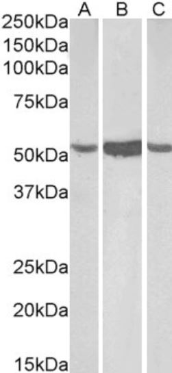 Western blot - Anti-ALDH1A1 antibody (AB9883)