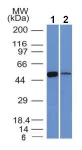 Western blot - Anti-ALDH1A1 antibody [ALDH1A1/1381] (AB219303)