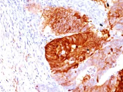Immunohistochemistry (Formalin/PFA-fixed paraffin-embedded sections) - Anti-ALDH1A1 antibody [ALDH1A1/1381] - BSA and Azide free (AB269761)