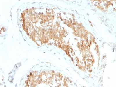 Immunohistochemistry (Formalin/PFA-fixed paraffin-embedded sections) - Anti-ALDH1A1 antibody [ALDH1A1/1381] - BSA and Azide free (AB269761)