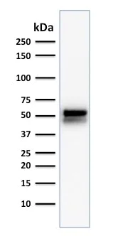 Western blot - Anti-ALDH1A1 antibody [ALDH1A1/1381] - BSA and Azide free (AB269761)