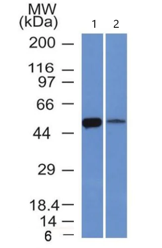 Western blot - Anti-ALDH1A1 antibody [ALDH1A1/1381] - BSA and Azide free (AB269761)