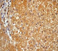 Immunohistochemistry (Formalin/PFA-fixed paraffin-embedded sections) - Anti-ALDH1A1 antibody [EP1932Y] - BSA and Azide free (AB206396)