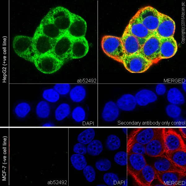 Immunocytochemistry/ Immunofluorescence - Anti-ALDH1A1 antibody [EP1933Y] - BSA and Azide free (AB215996)