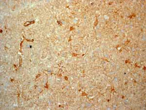 Immunohistochemistry (Formalin/PFA-fixed paraffin-embedded sections) - Anti-ALDH1A1 antibody [EP1933Y] - BSA and Azide free (AB215996)