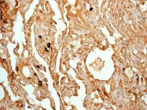 Immunohistochemistry (Formalin/PFA-fixed paraffin-embedded sections) - Anti-ALDH1A1 antibody [EP1933Y] - BSA and Azide free (AB215996)