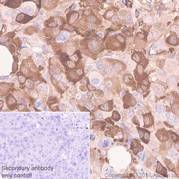 Immunohistochemistry (Formalin/PFA-fixed paraffin-embedded sections) - Anti-ALDH1A1 antibody [EP1933Y] - BSA and Azide free (AB215996)