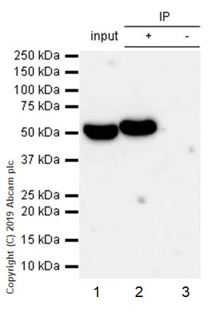 Immunoprecipitation - Anti-ALDH1A1 antibody [EP1933Y] - BSA and Azide free (AB215996)