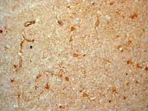 Immunohistochemistry (Formalin/PFA-fixed paraffin-embedded sections) - Anti-ALDH1A1 antibody [EP1933Y] - C-terminal (ab52492), expandable thumbnail