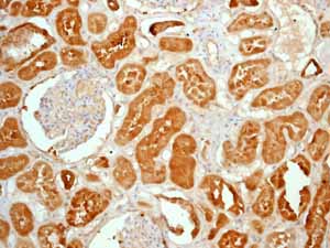 Immunohistochemistry (Formalin/PFA-fixed paraffin-embedded sections) - Anti-ALDH1A1 antibody [EP1933Y] - C-terminal (ab52492), expandable thumbnail
