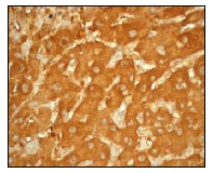 Immunohistochemistry (Formalin/PFA-fixed paraffin-embedded sections) - Anti-ALDH1A1 antibody [EP1933Y] - C-terminal (ab52492), expandable thumbnail