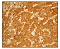 Immunohistochemistry (Formalin/PFA-fixed paraffin-embedded sections) - Anti-ALDH1A1 antibody [EP1933Y] - C-terminal (AB52492)